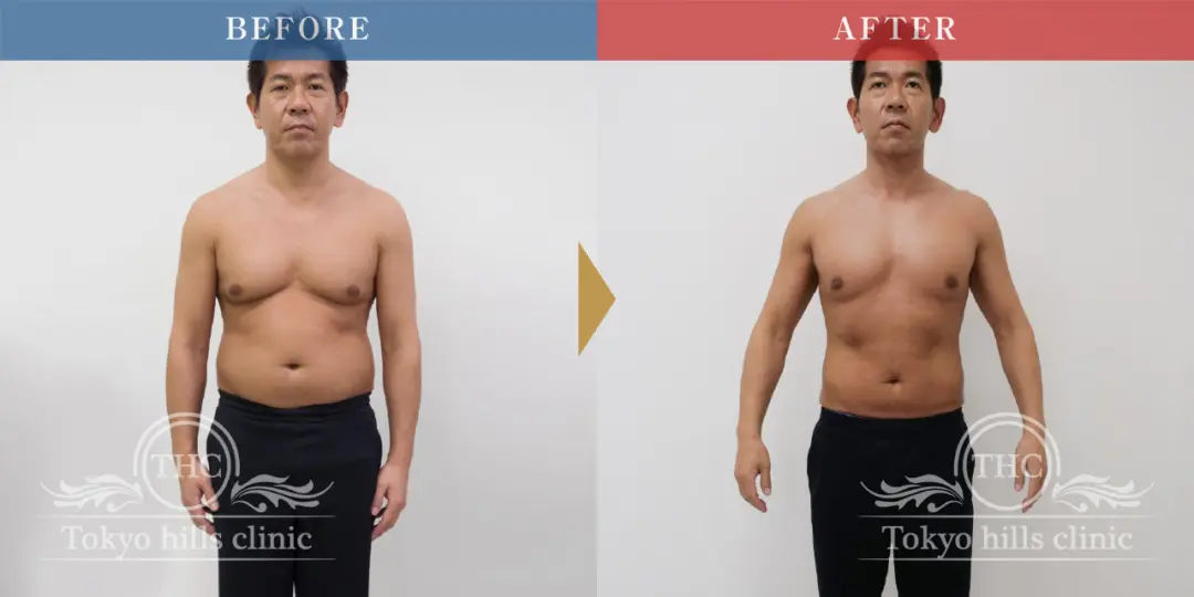 CASE1 Before/After 1