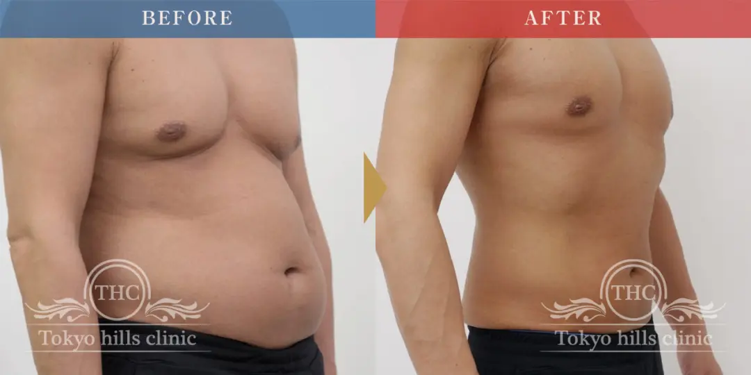 CASE1 Before/After 2