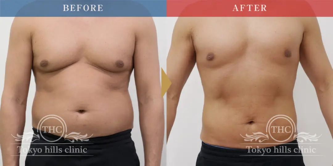 CASE1 Before/After 3