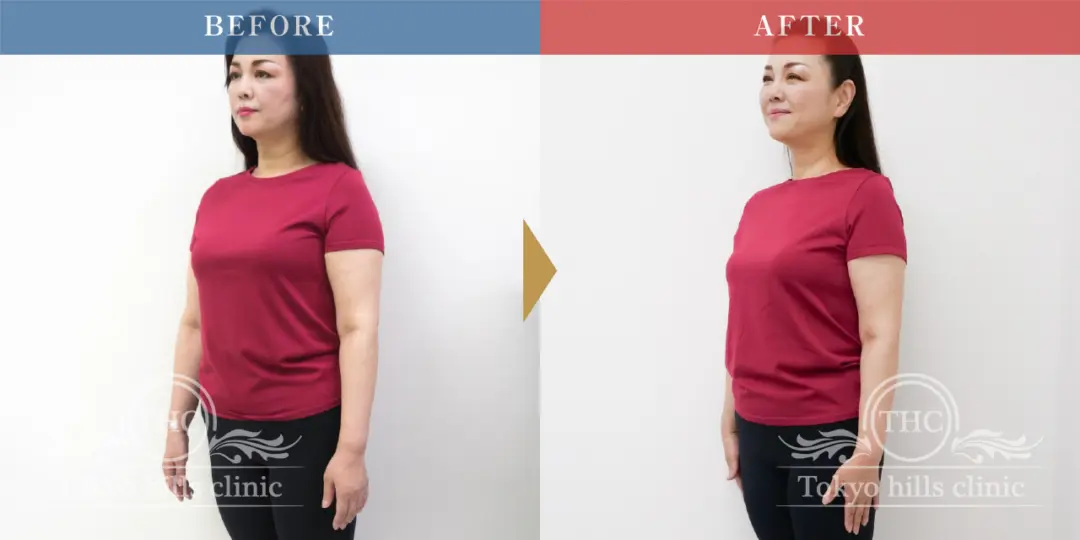 CASE2 Before/After 2