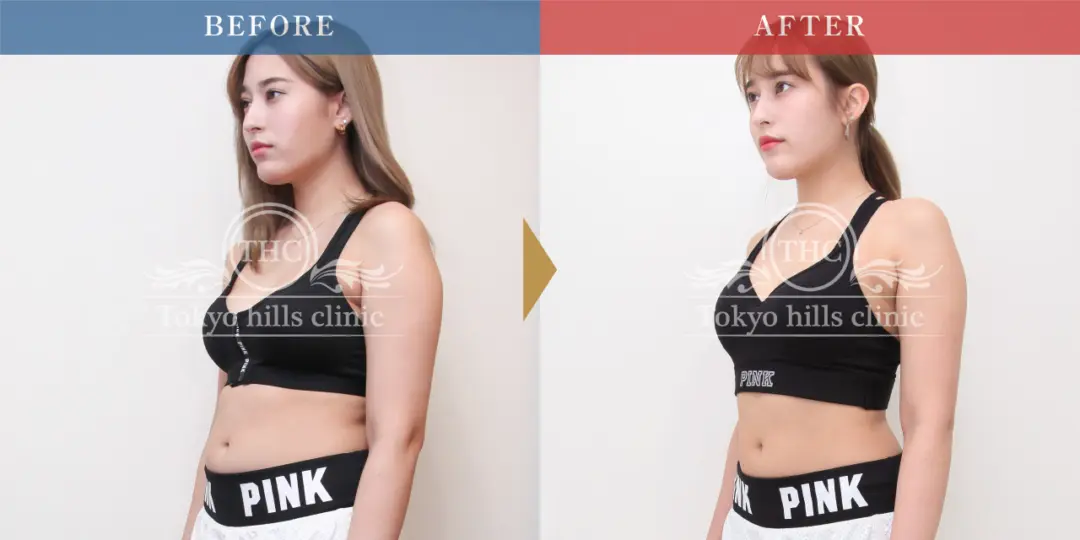 CASE3 Before/After 2