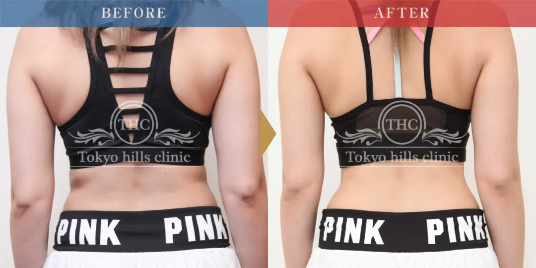 CASE3 Before/After 3